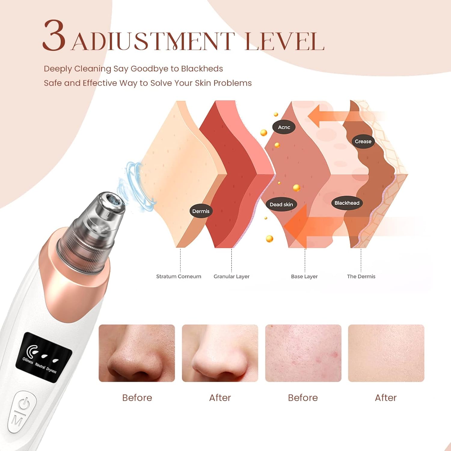 VacuaSkin™ Deep Pore Facial Vacuum